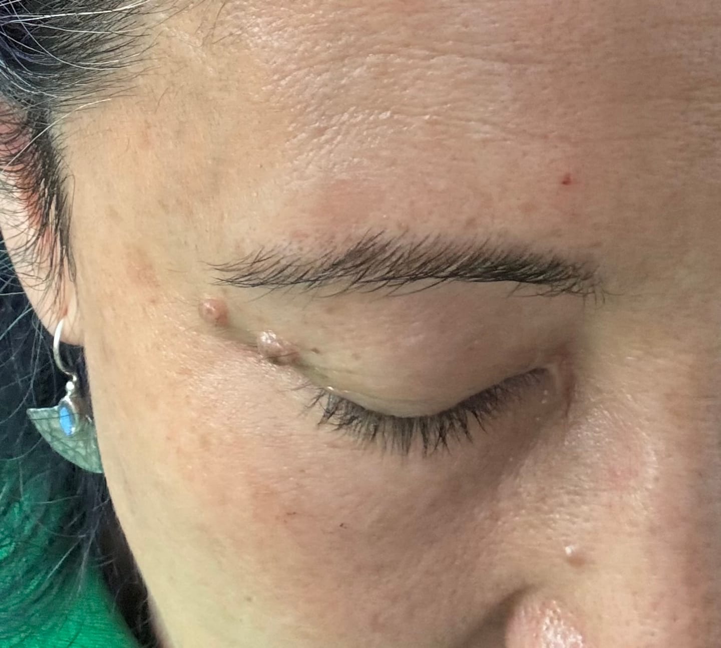 Customer photo review of NEW & IMPROVED LASH SERUM