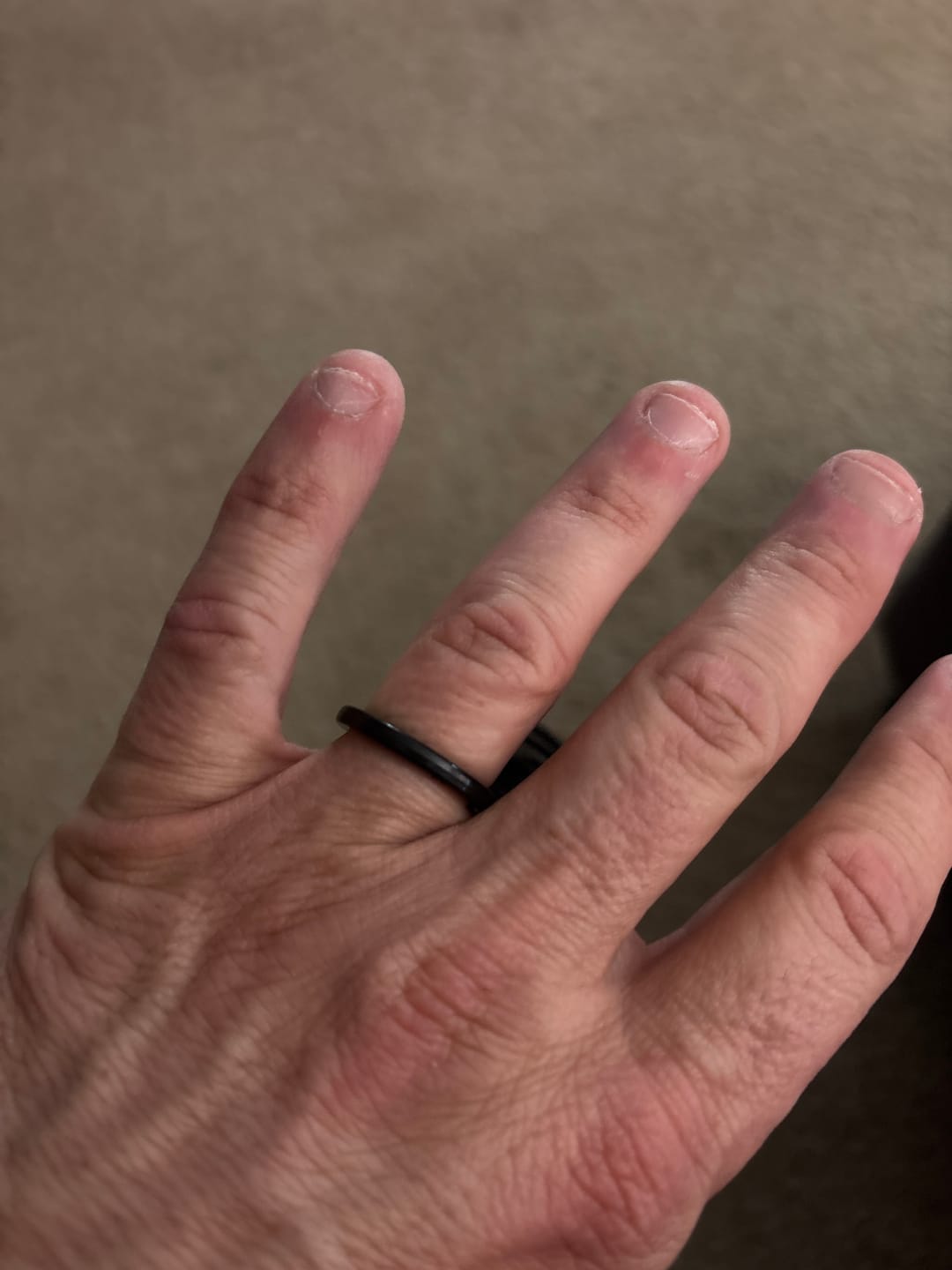 Customer photo review of Thorum Ring Sizer