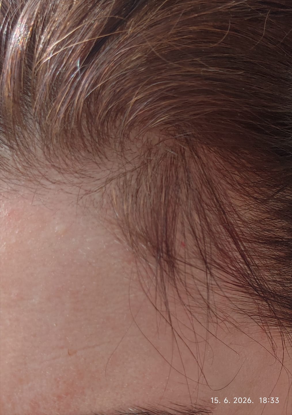 Customer photo review of Hair Boost