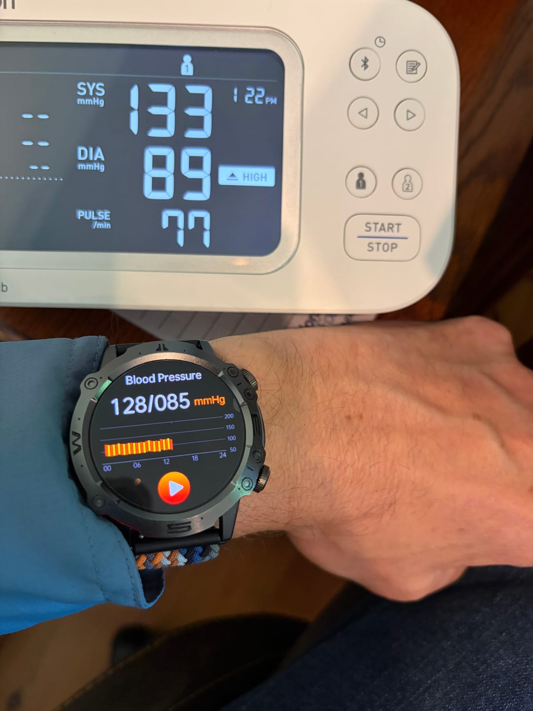 Customer photo review of Bearscome PRO 3 High-end ECG/EKG blood sugar health HD sports smart watch