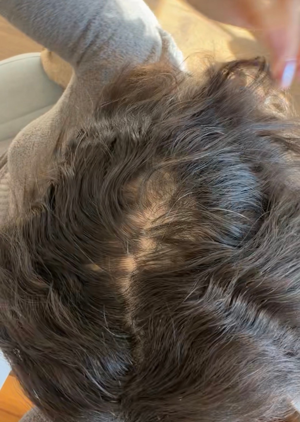 Real Growplex customer scalp