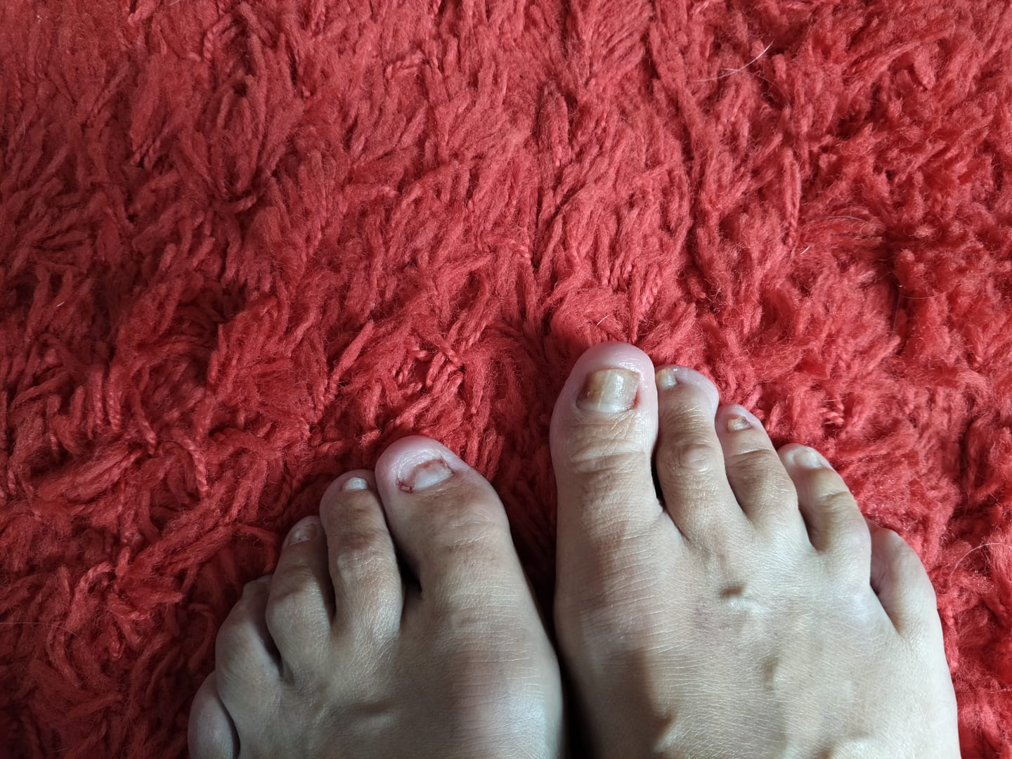 Customer photo review of Fungal Freedom