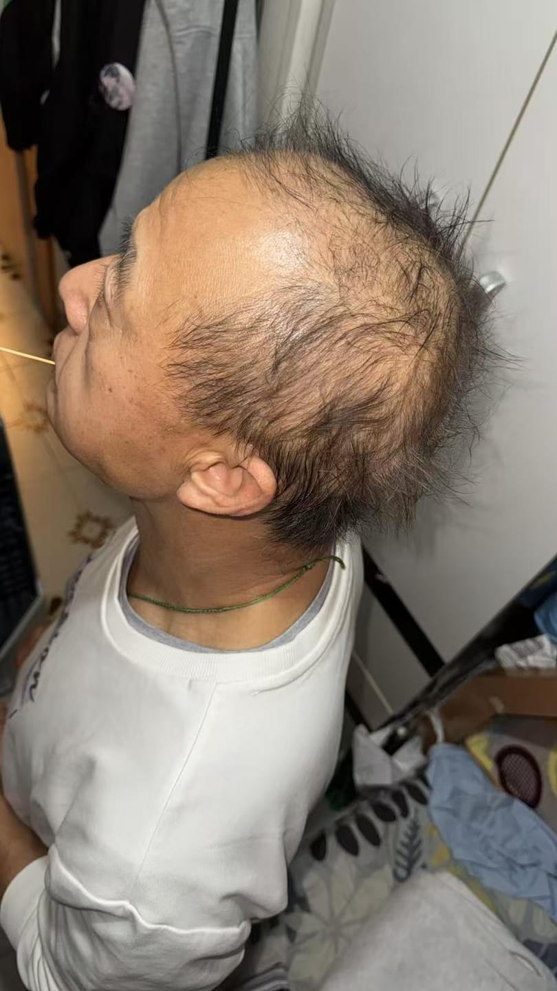Customer photo review of [IN] Youth - Cure antichute cheveux
