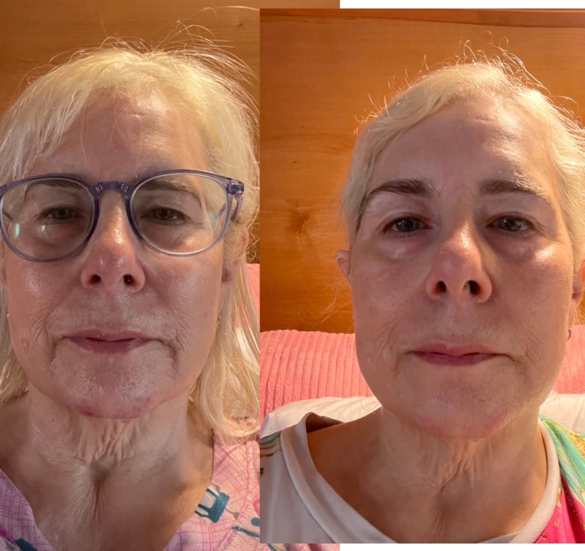 Customer photo review of Deep Collagen Cream