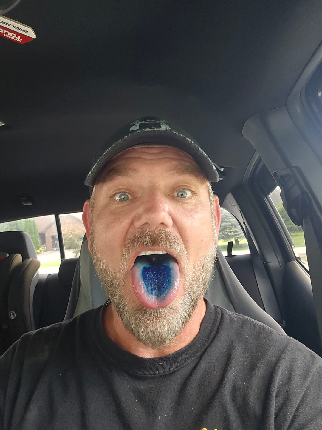 Customer photo review of Methylene Blue Tincture