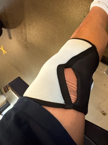 Customer photo review of Reversible Knee Sleeves - Black/White