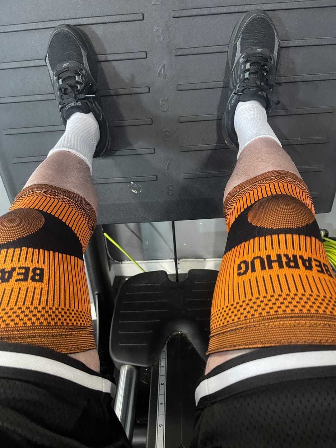 Customer photo review of Pair of Knee Supports For Arthritic Pain Relief & Recovery