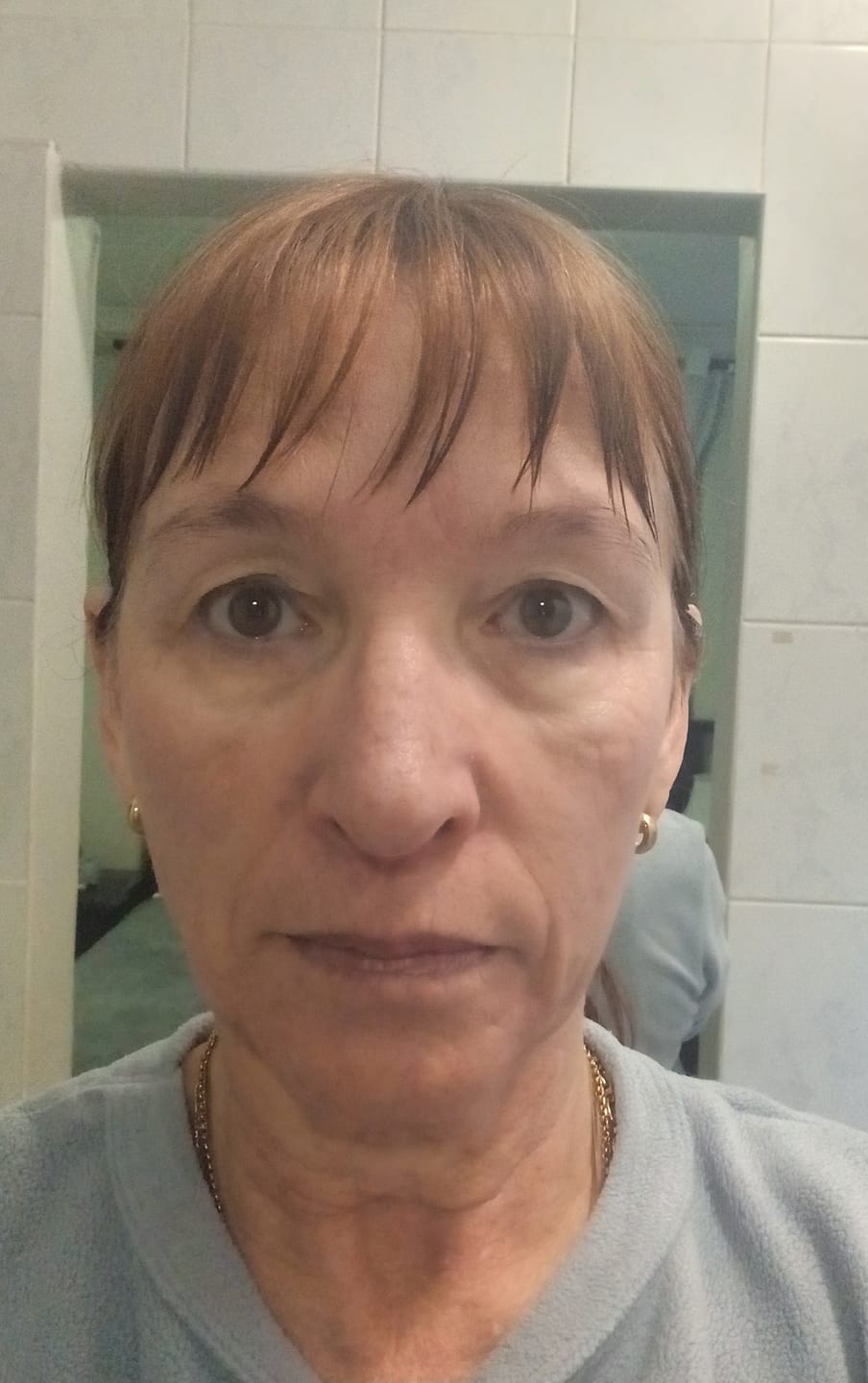 Customer photo review of Buy a Caviar Face Cream, Get a Free Vitamin C Serum