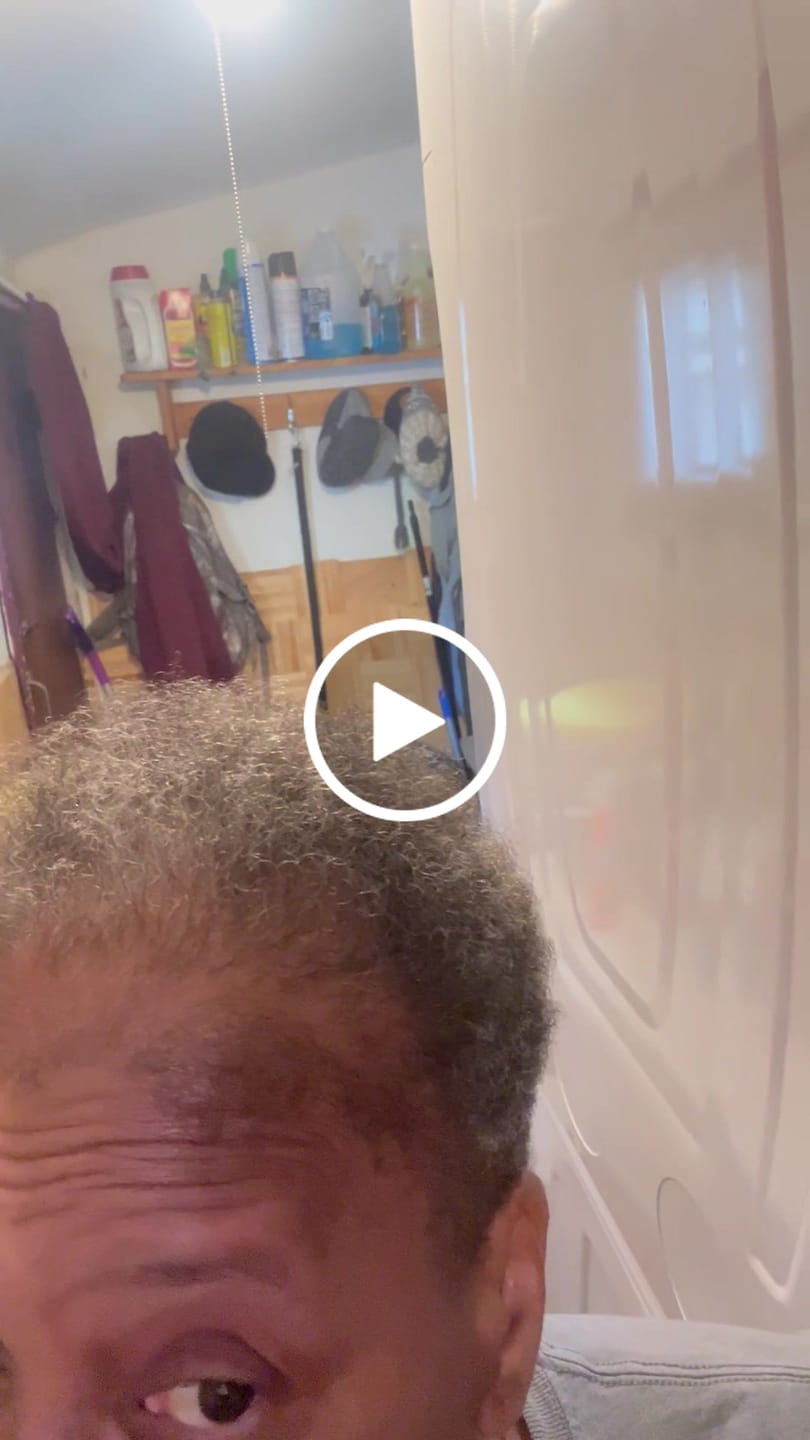 Customer video review of Rennora EXTRA-Strength Hair Growth Serum