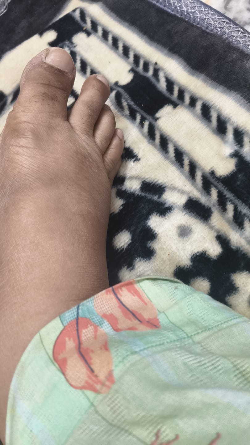 Customer photo review of Hand & Foot Brightening Bundle
