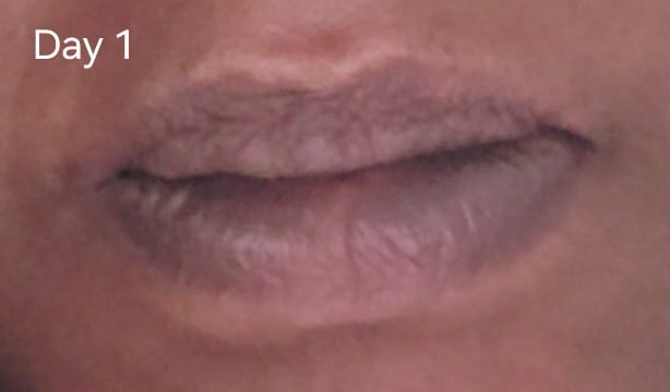 Customer photo review of Brightening Lip Bundle