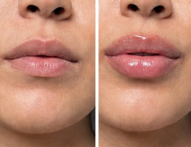 Customer photo review of Kiss Me More Lip Plumper
