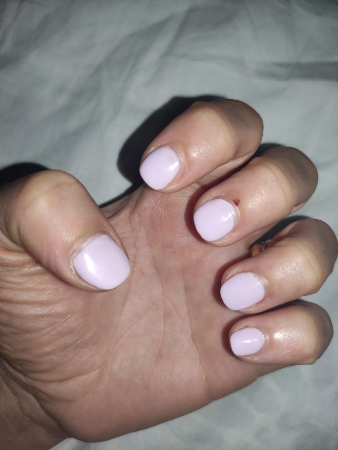 Customer photo review of Restructura Base&Go 11 - Rubber Base Hema Free - 15 ml  LCI