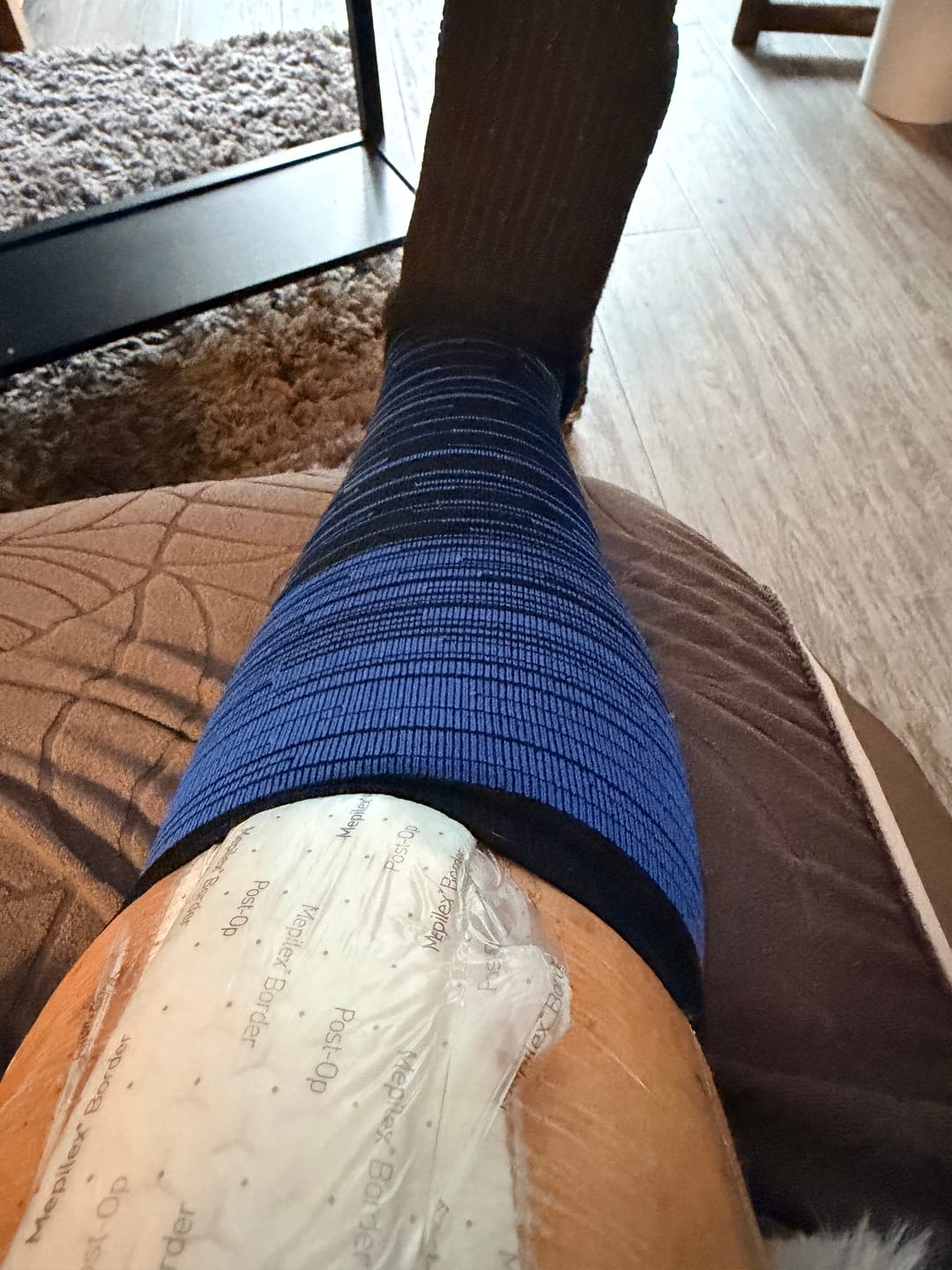 Customer photo review of EverSock™ Wide Compression Socks For Pain Relief (Stripes)