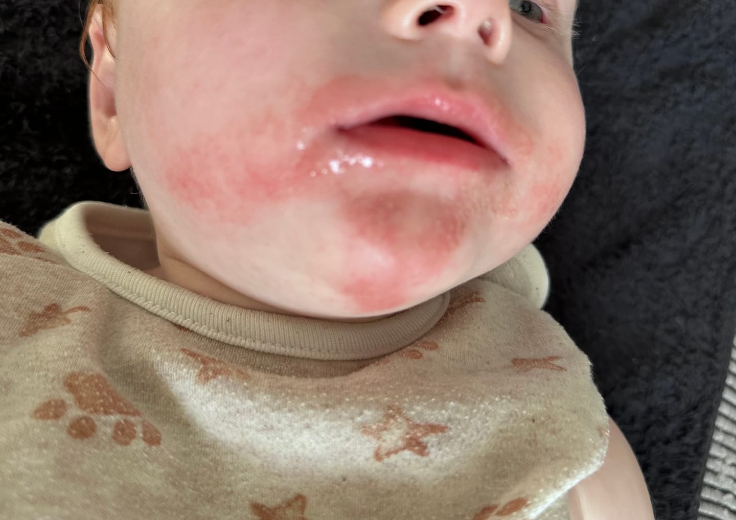 Customer photo review of Small Starter Kit | Grass-Fed Face Cream, Balm and Soap