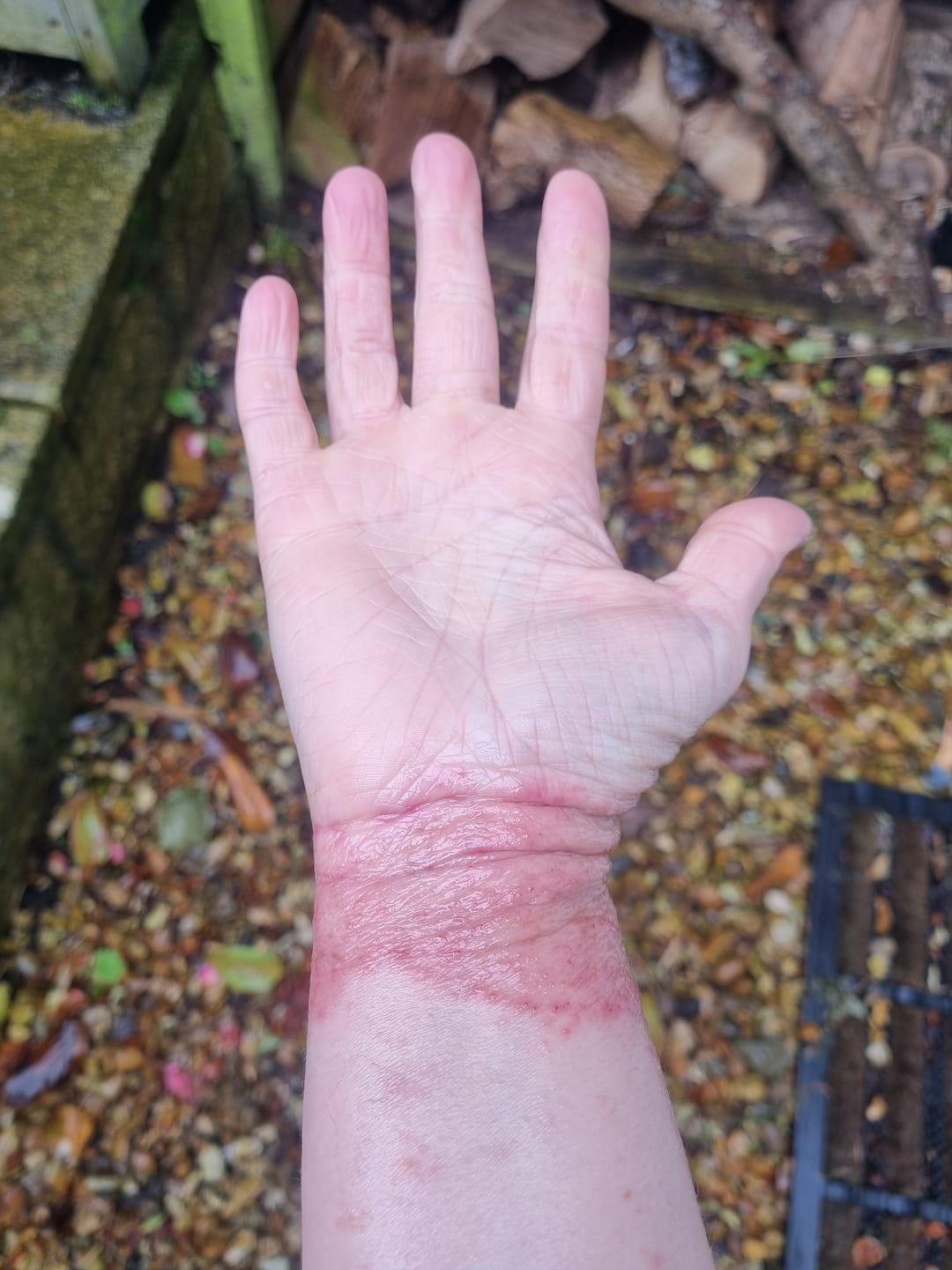 Customer photo review of Grass-Fed Tallow Body Balm | Cold Weather Protection