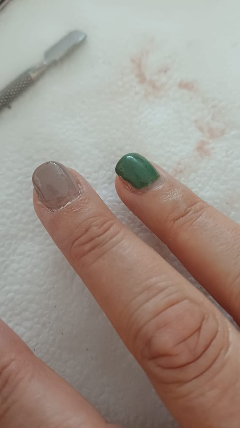 Customer photo review of Verwijderkom