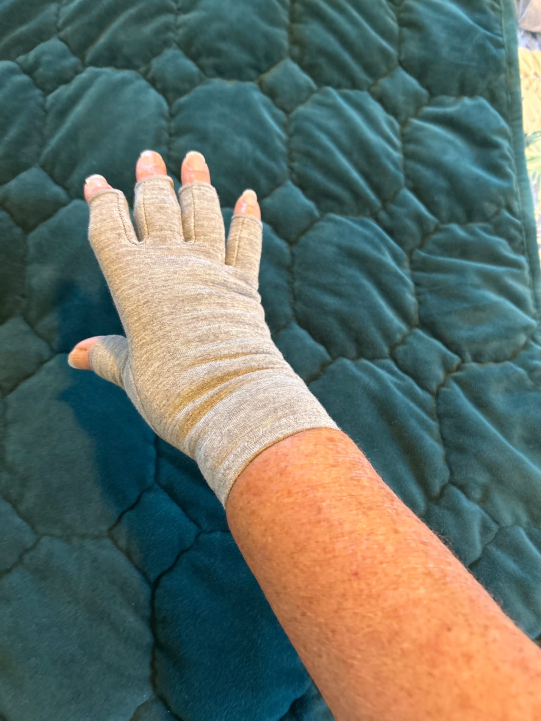 Customer photo review of Premium Onecompress™ Gloves