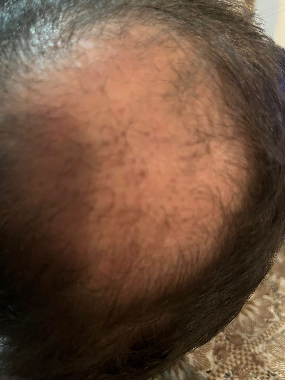 Customer photo review of Full Regrowth Kit™