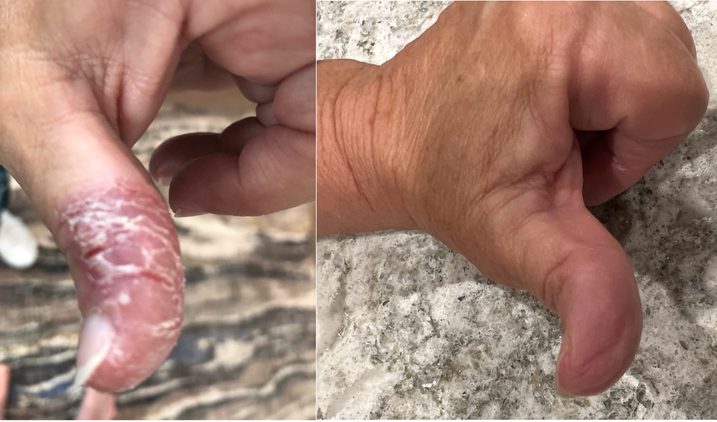 Customer photo review of Crescel Skin Renewal Cream - 3.4 oz