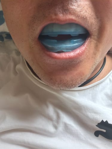 Customer photo review of SILEN いびき防止マウスピース