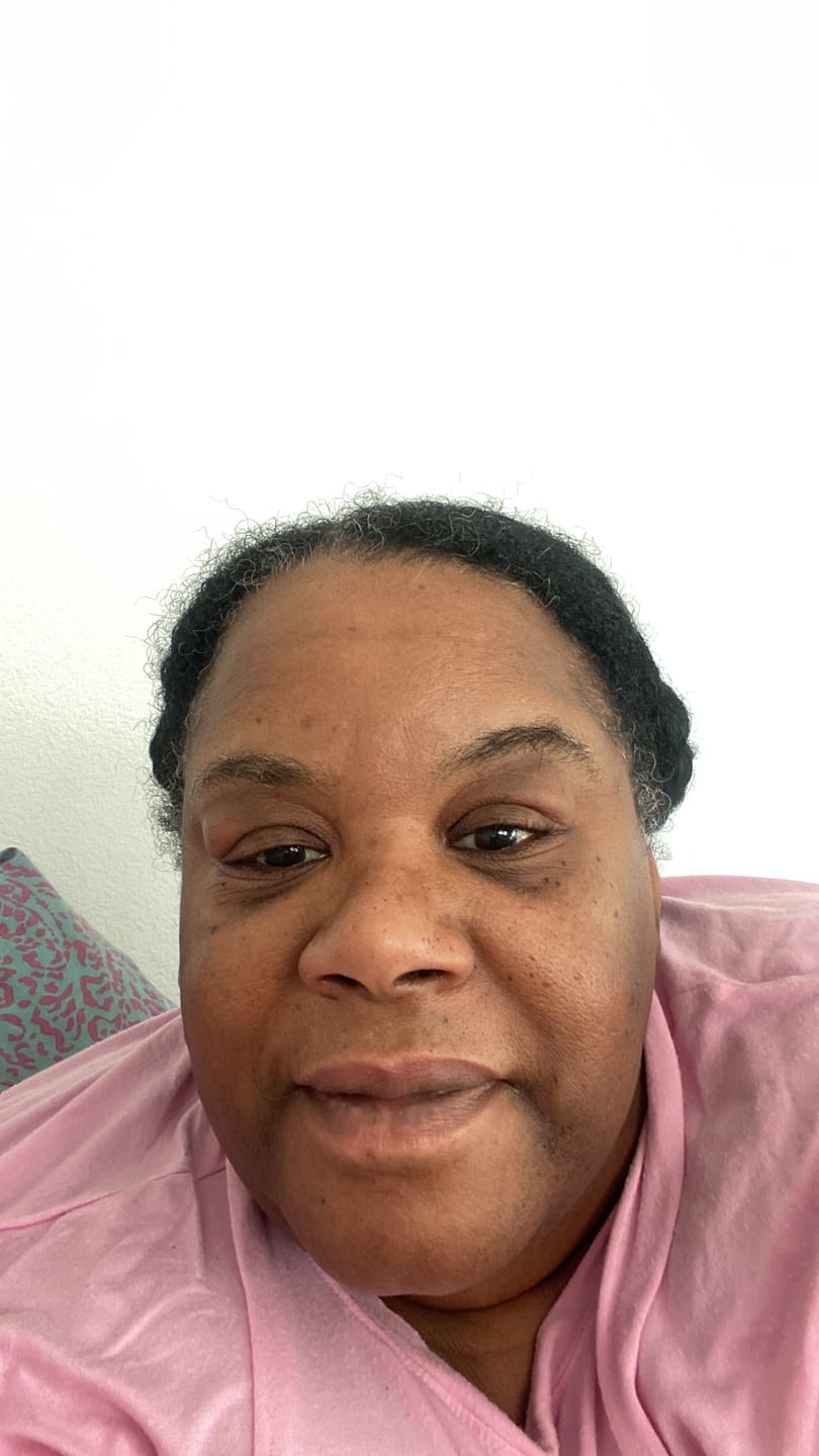 Customer photo review of GLO MELANIN