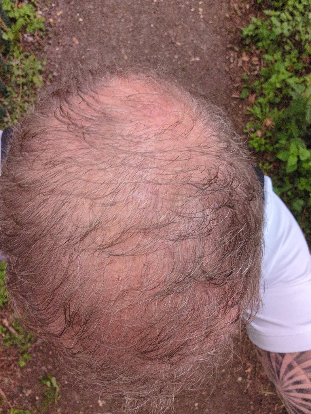 Customer photo review of 1 Month Supply Root Activator Spray (sc)