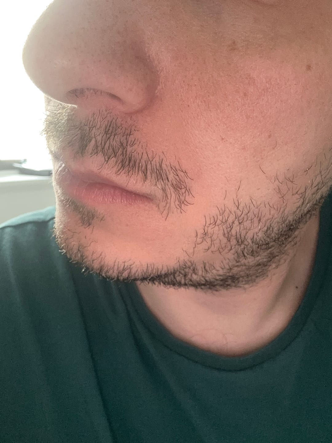 Customer photo review of Seb Natural Soothing Balm