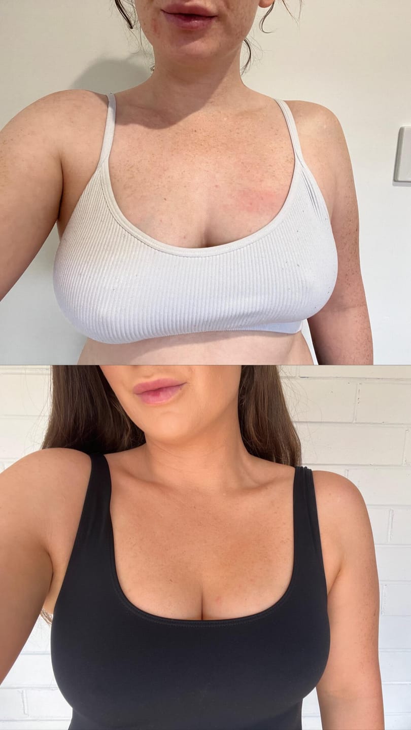 Customer photo review of Self Tanning Foam