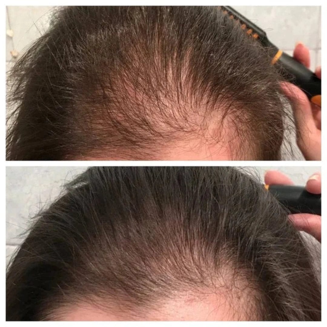 Customer photo review of Apex Hair Growth System