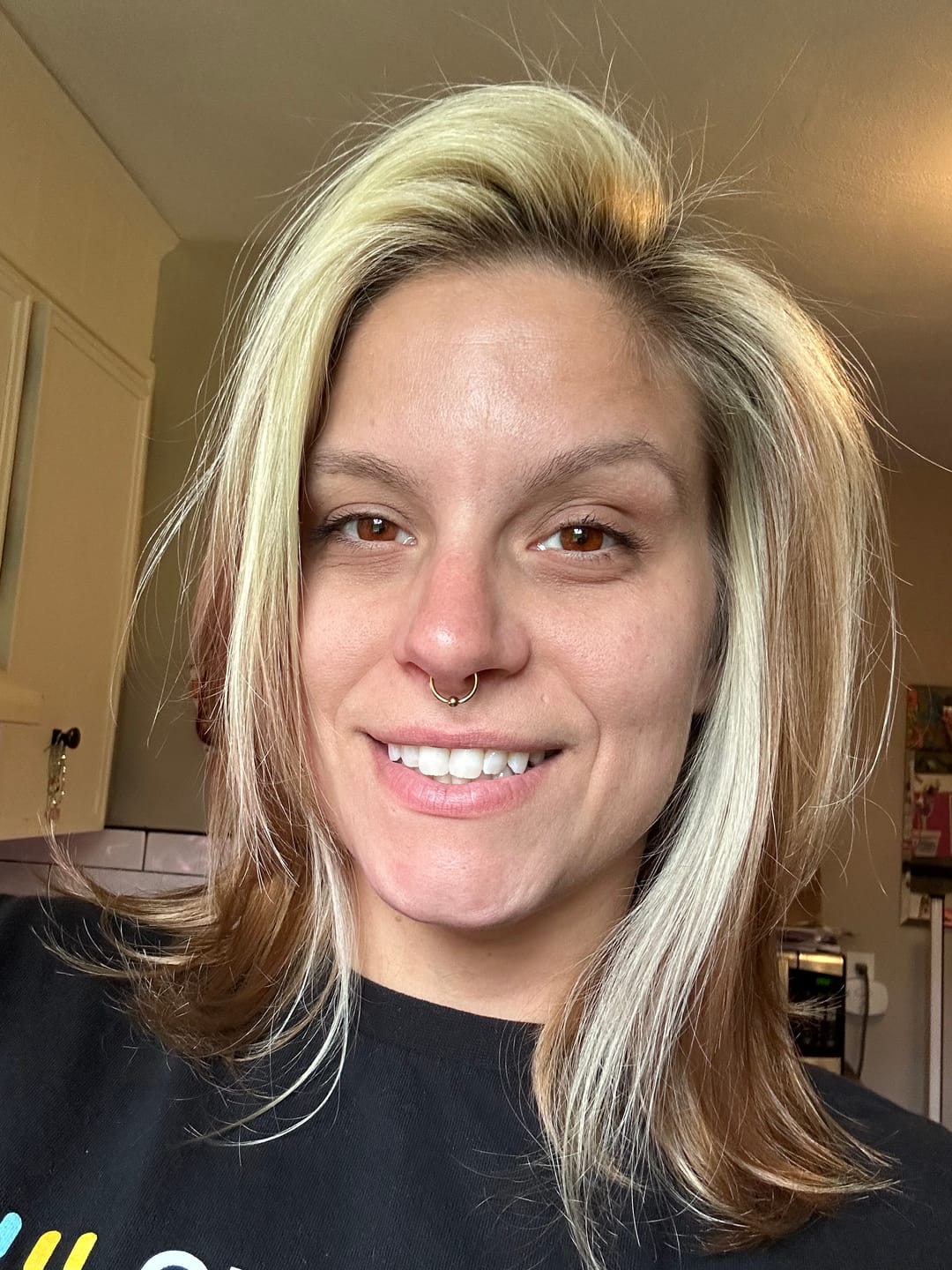 Customer photo review of Eyeling FL-41 light sensitivity contact lenses