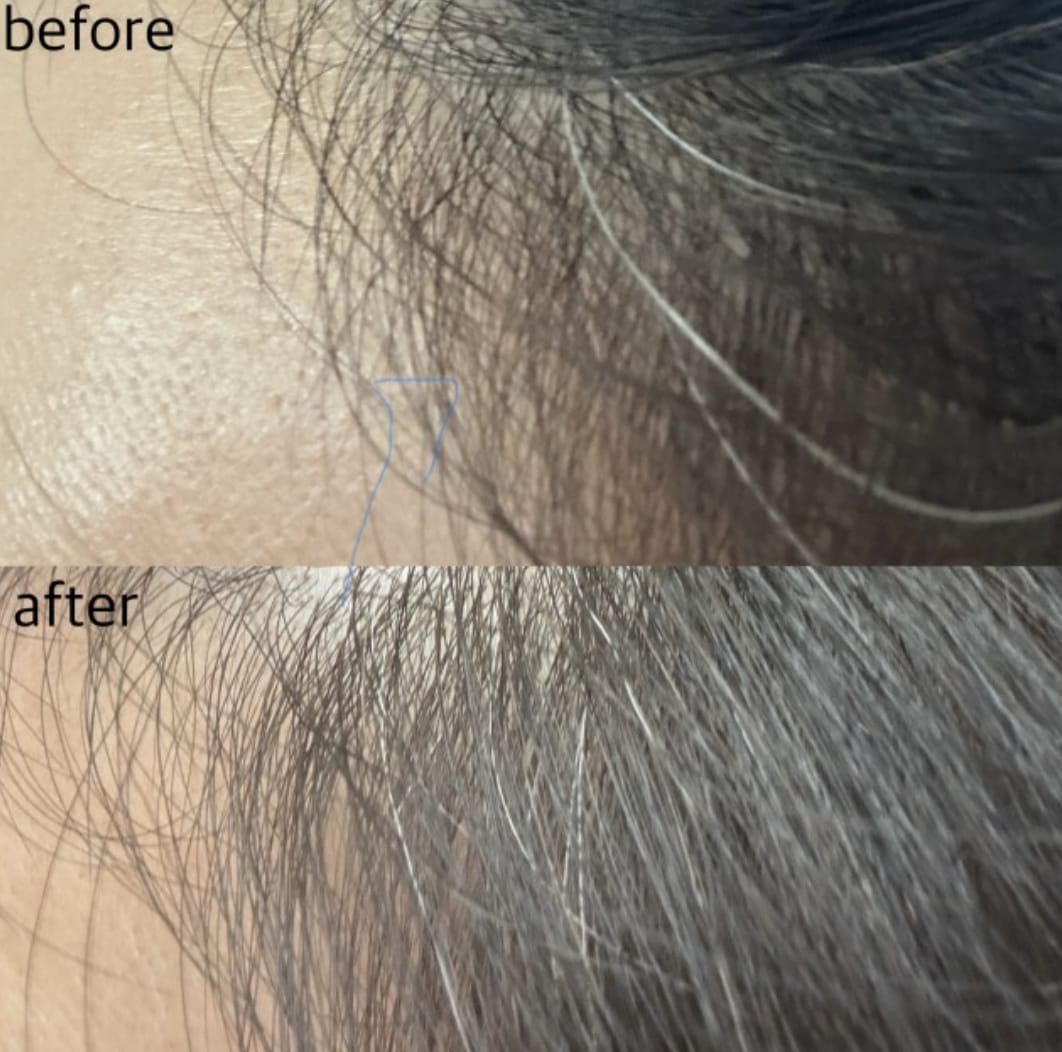 Customer photo review of GDS Hair Dye Shampoo — Grey Coverage in 3 Minutes