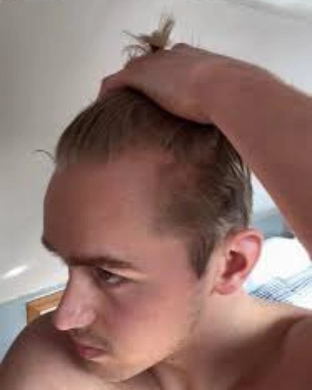 Customer photo review of Apex Hair Growth System