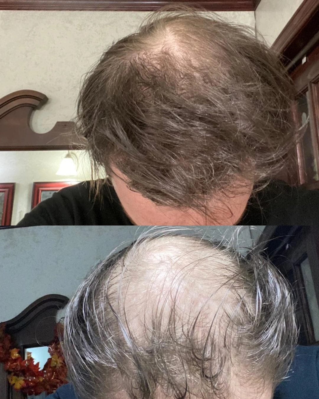 Customer photo review of Apex Hair Growth System