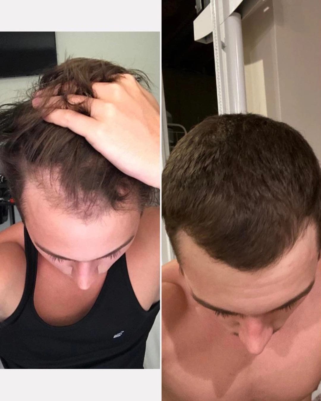 Customer photo review of Apex Hair Growth System