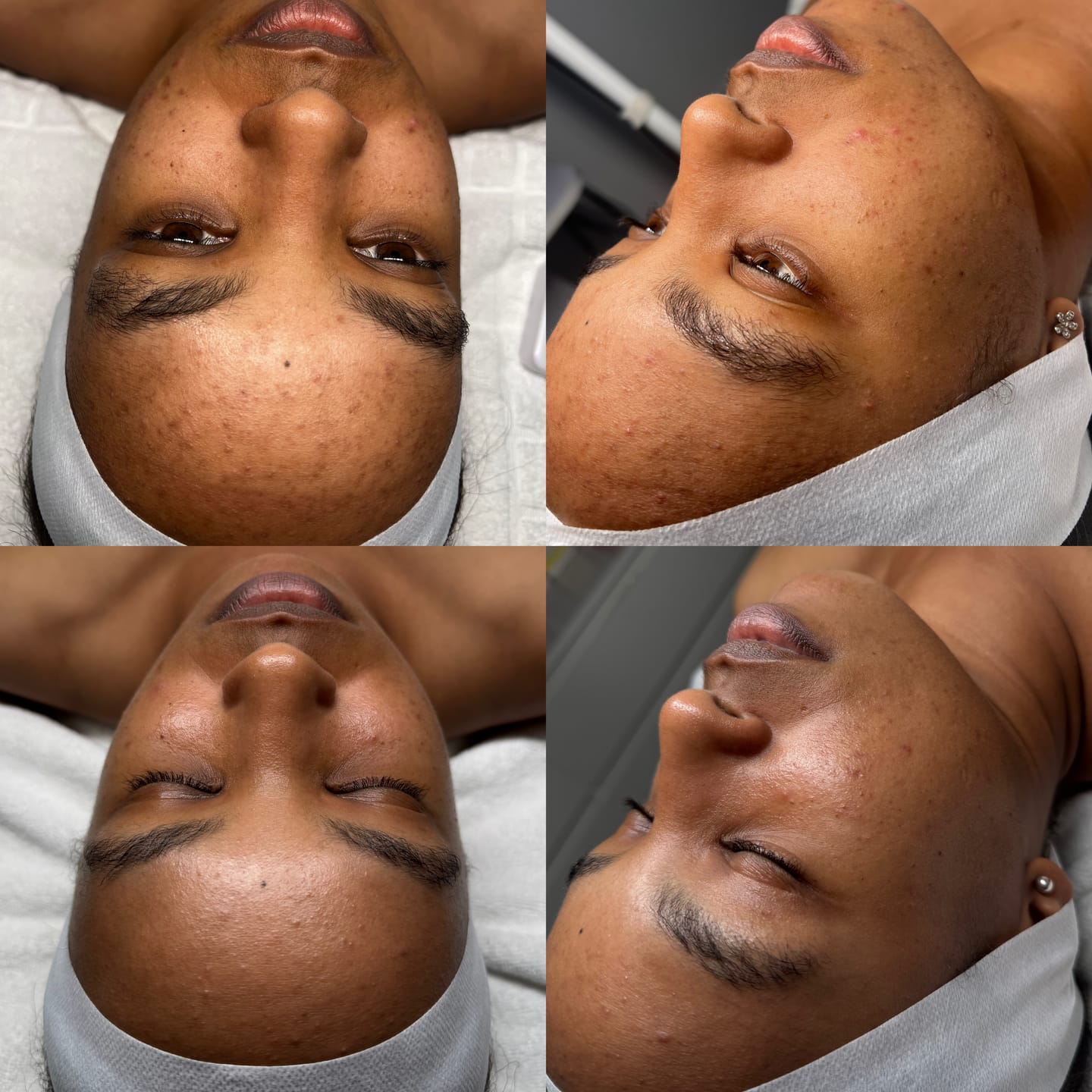 Customer photo review of Zena 100% Organic Algae Peel