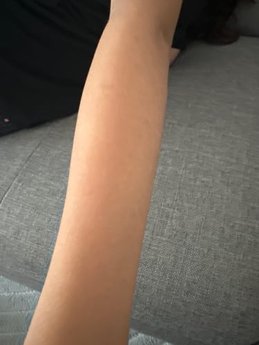 Customer photo review of Premium Haarfrei Bundle