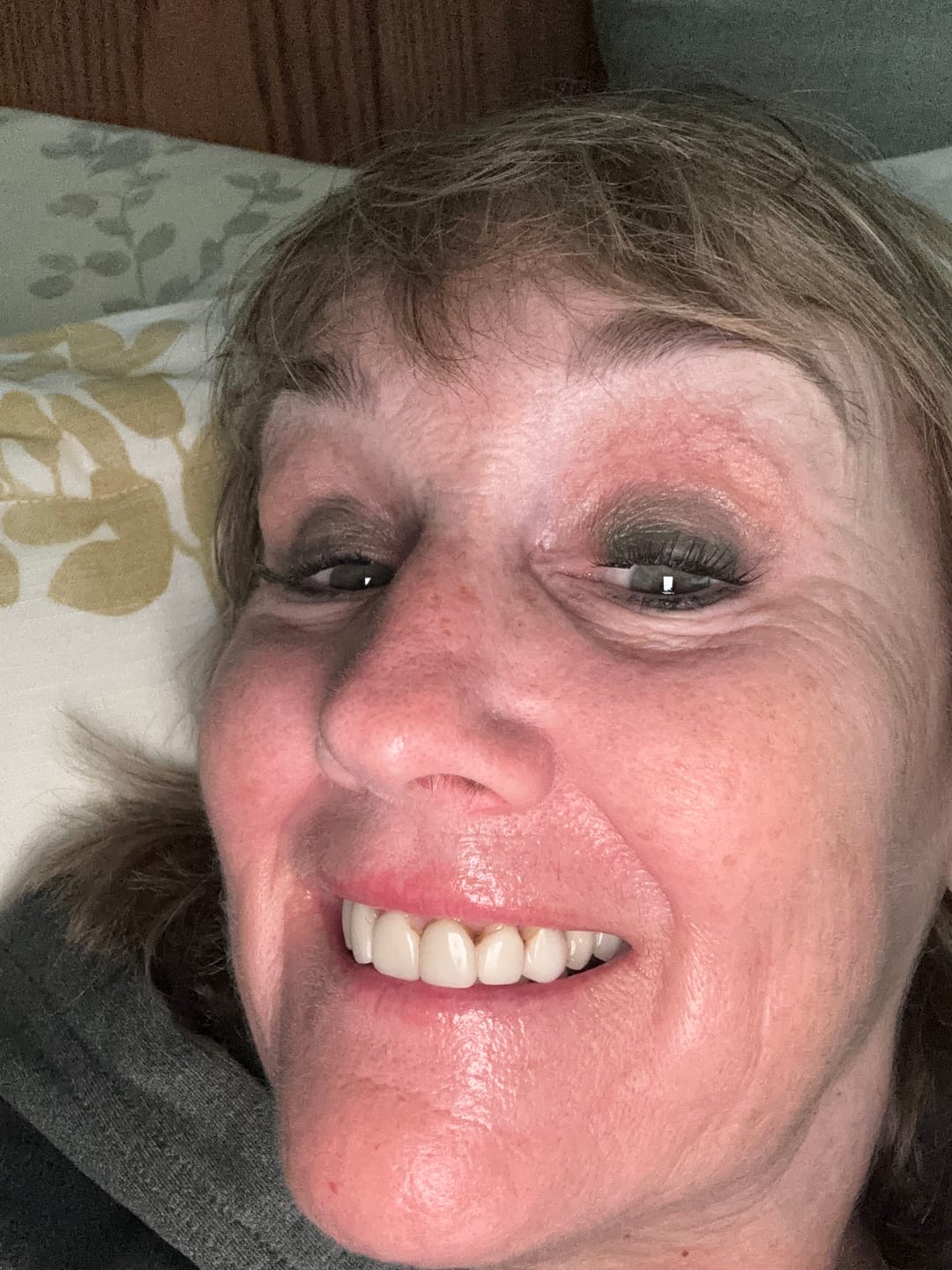 Customer photo review of Lashify Order Protection+