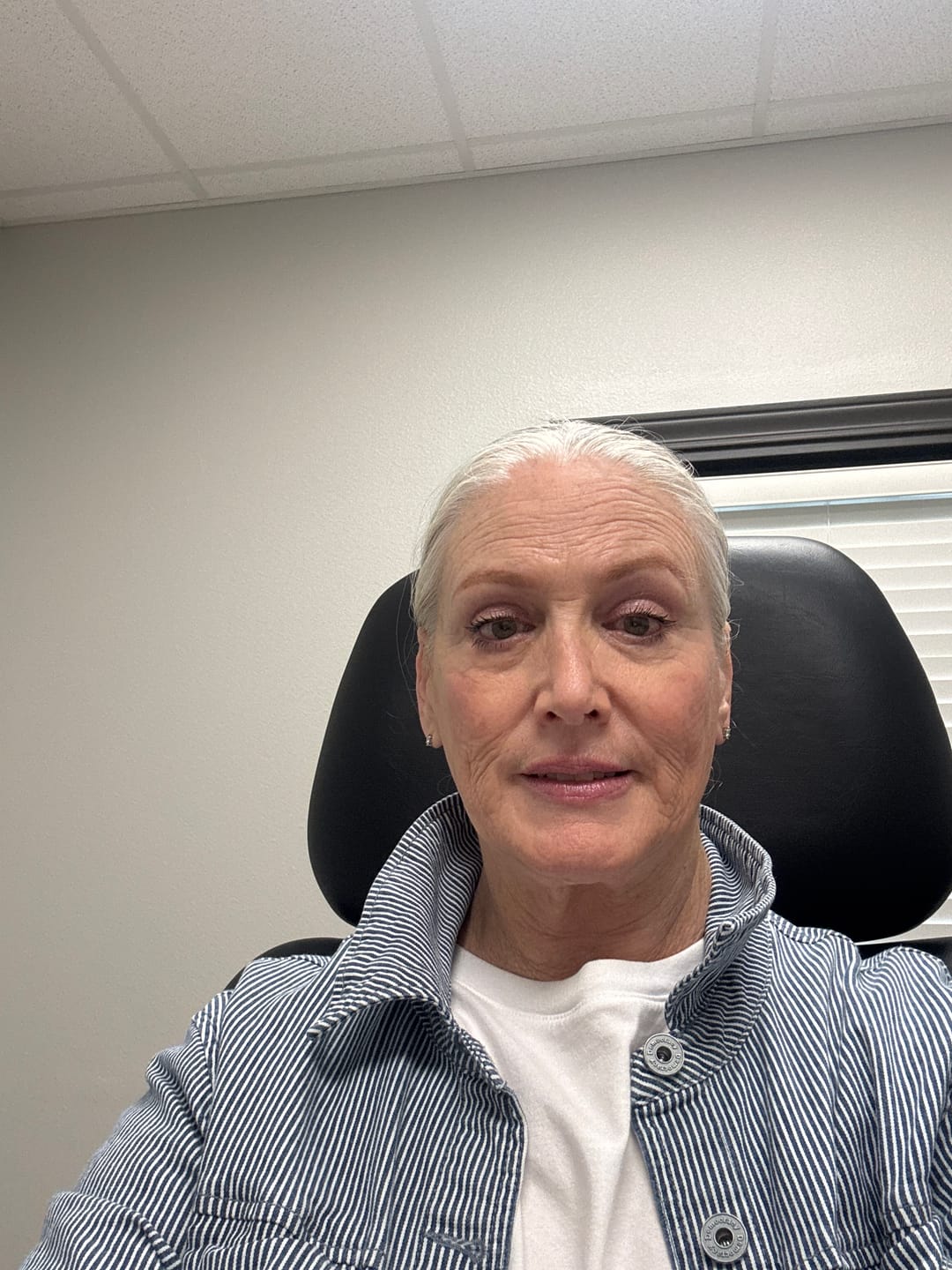 Customer photo review of 3 Month Supply - Seranova Micro Infusion System