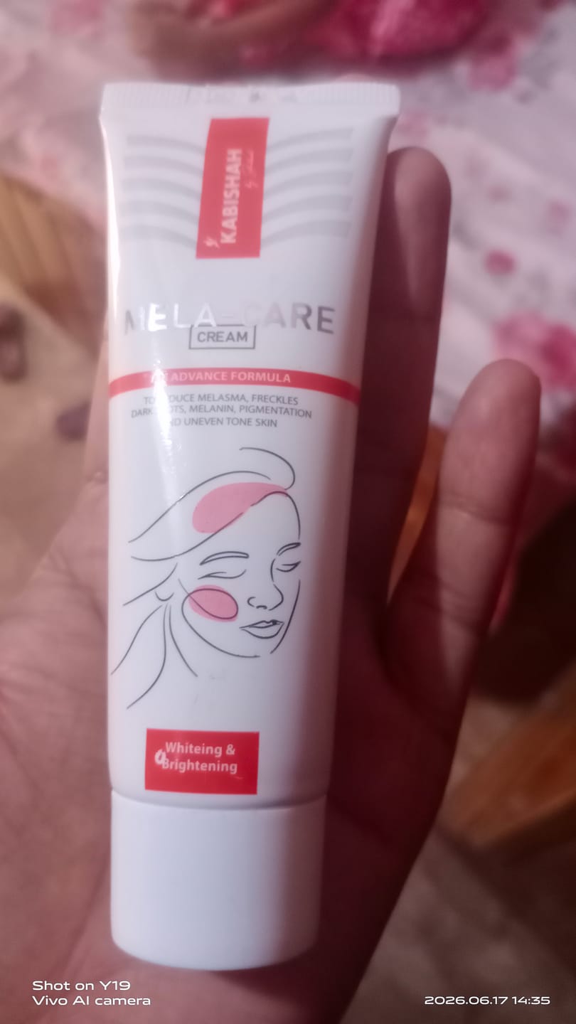 Customer photo review of Mela Care Advanced Brightening Cream Double Pack Bundle