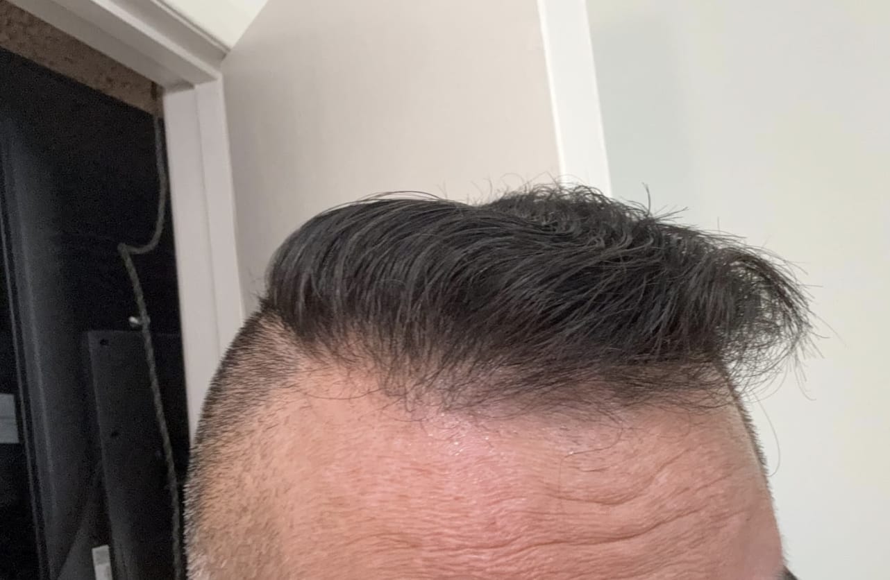 Customer photo review of GDS Hair Dye Shampoo — Grey Coverage in 3 Minutes