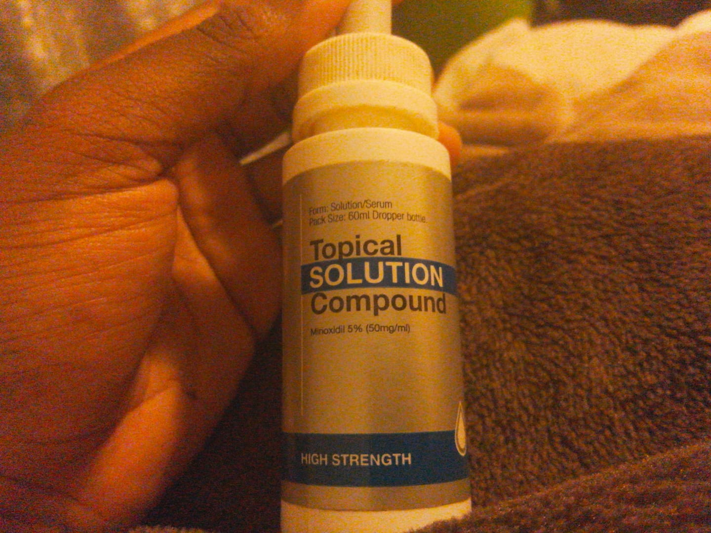 Customer photo review of Minoxidil 5% Solution, 1 x 60ml pack