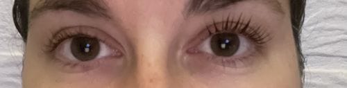 Customer photo review of SimplyLash kit