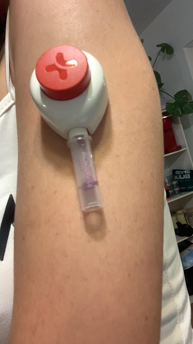 Customer photo review of EarlyReveal Tap DNA Gender Test Over 99% Accurate | Painless & Needle Free