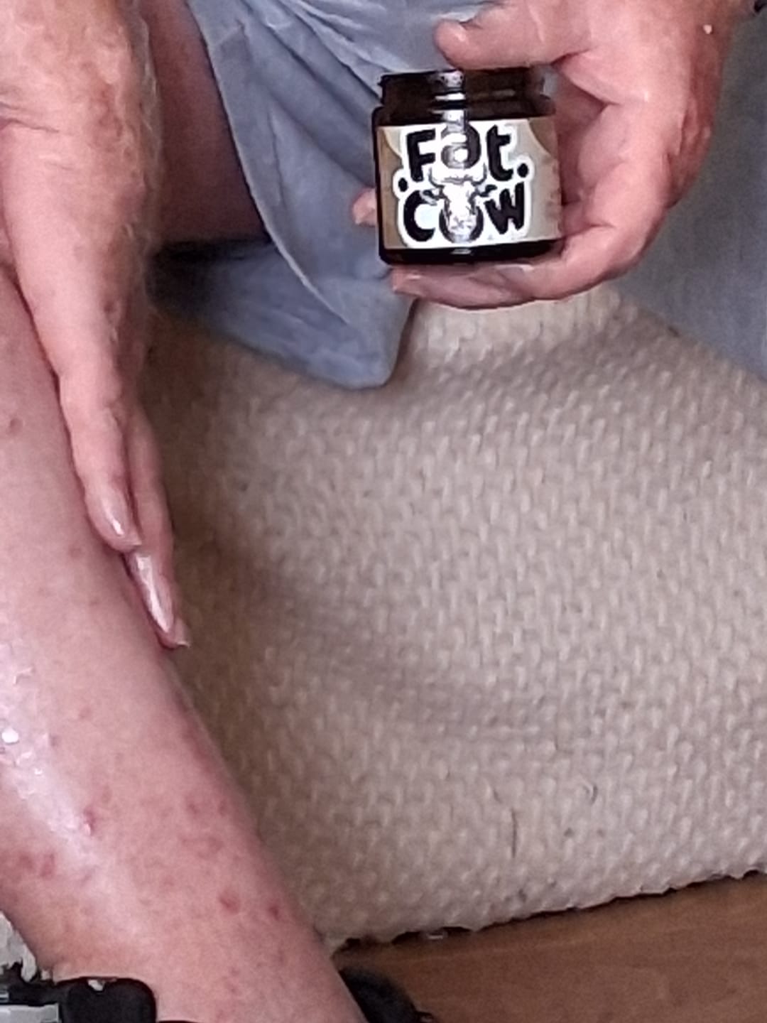Customer photo review of Grass-Fed Tallow Body Balm | Cold Weather Protection