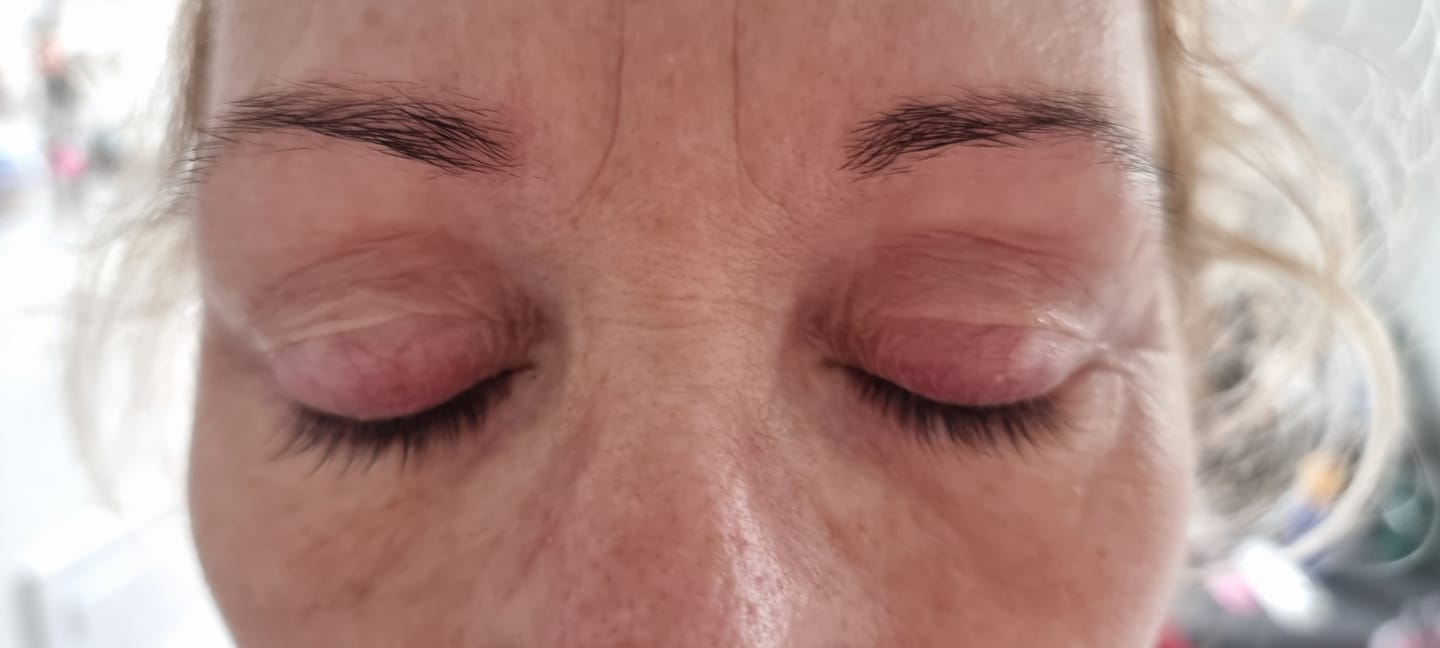 Customer photo review of LASHCOCA!NE - Wimpernserum