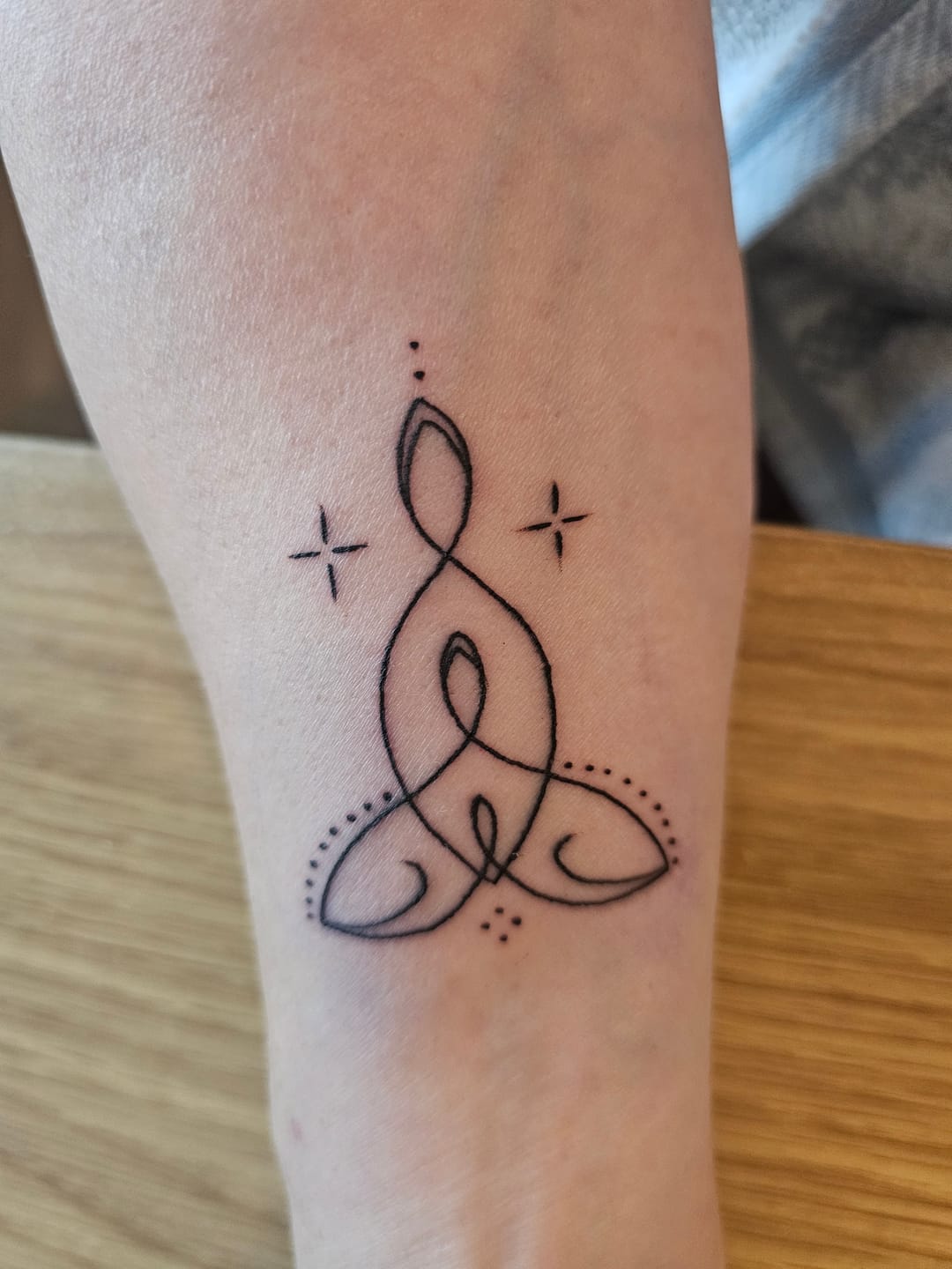 Customer photo review of TattooNumbx Numbing Cream