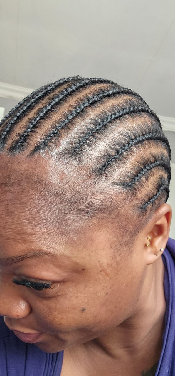 Customer photo review of Minoxidil REGULAR (2%) strength SOLUTION, 3month supply