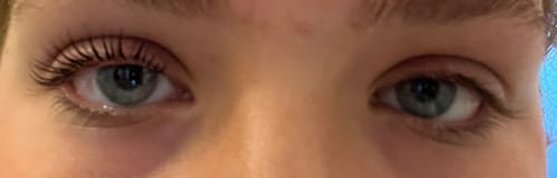 Customer photo review of SimplyLash kit