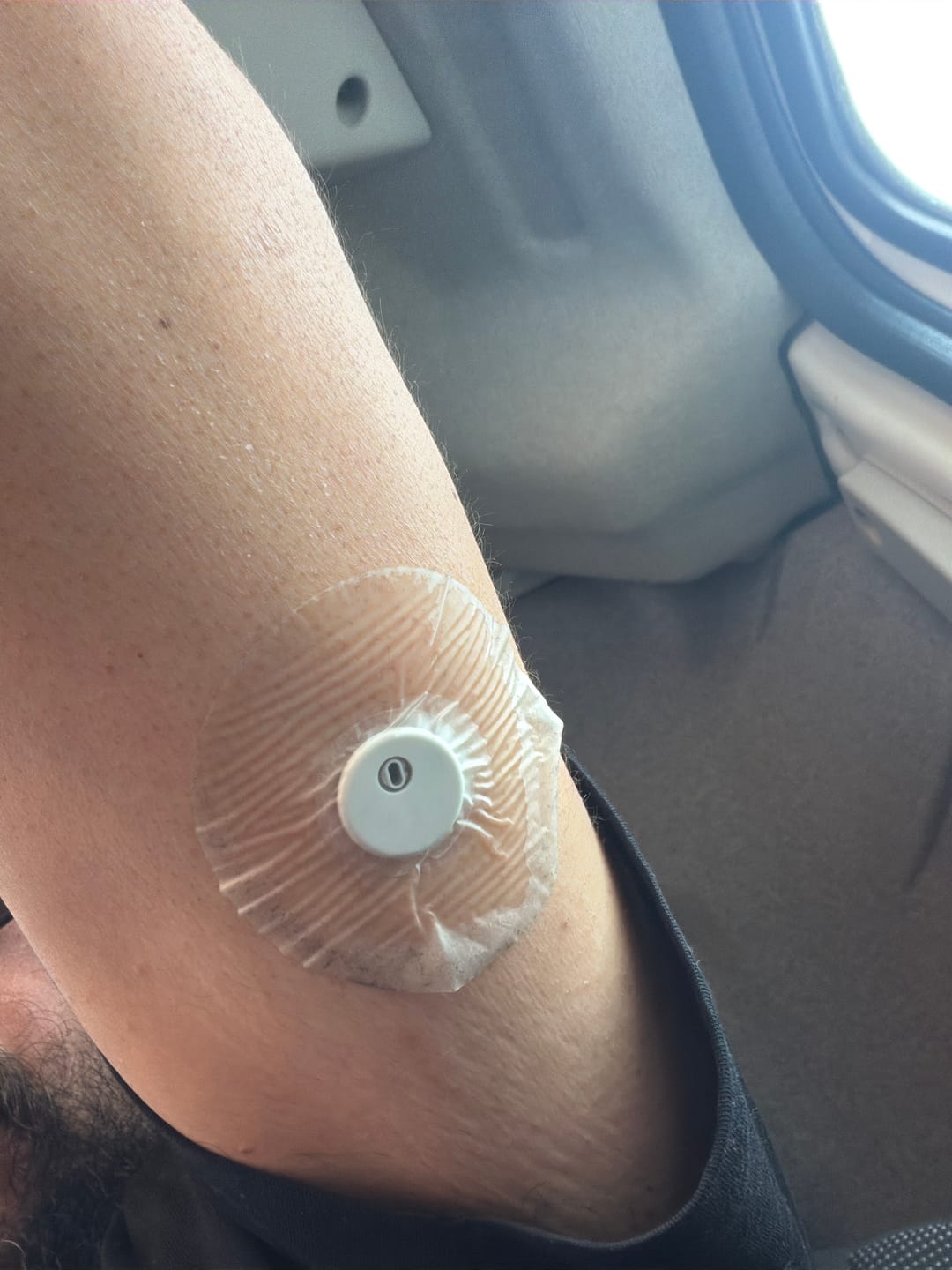 Customer photo review of Freestyle Libre 1, 2 & 3 Transparent CGM Patch